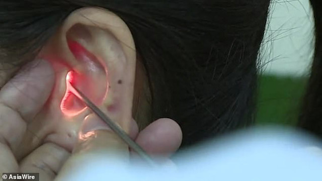 13 bin kişide bir görülüyor! Erkeklerin sesini duymayan kadın şoke etti - Resim: 3