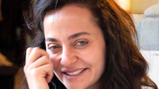 Diriliş Ertuğrul'un güzel oyuncusu sahte doktor kurbanı Son hali şoke etti - Resim: 2