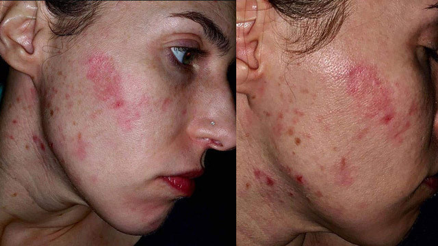 Önce göğsünde çıktı sonra yüzünü yemeye başladı! - Resim: 4