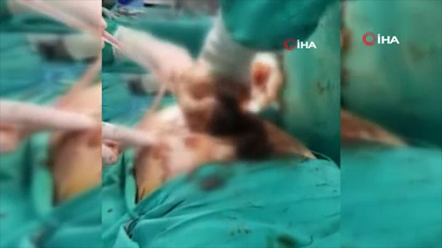 Ameliyatı yapan doktor şoke oldu! Midesinden çıkana bakın - Resim: 2