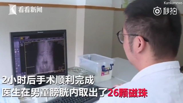 Penisinden çıkan şeyler şok etti! Tam 26 adet bakın nasıl içine girmiş - Resim: 4