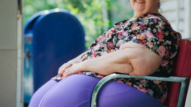 Uzmanlar karın bölgesindeki yağlama konusunda uyardı! - Resim: 4