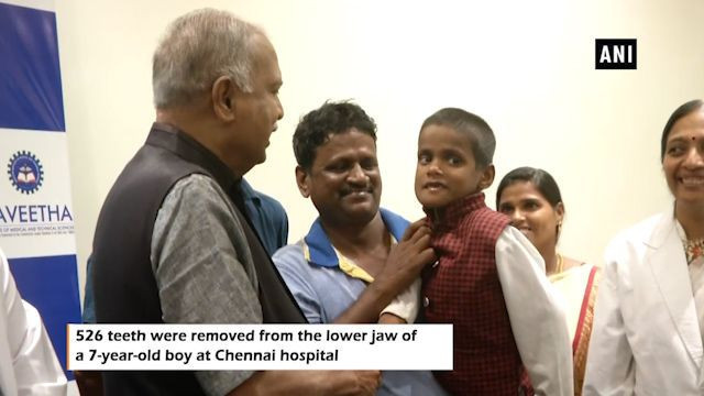 Çocuğun ağzında 526 diş bulundu tıp dünyasını şoke eden olay! - Resim: 4