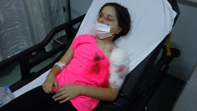 Samsun'da pitbull 11 yaşındaki çocuğu bu halde getirdi! Kanlar içinde kaldı - Resim: 1