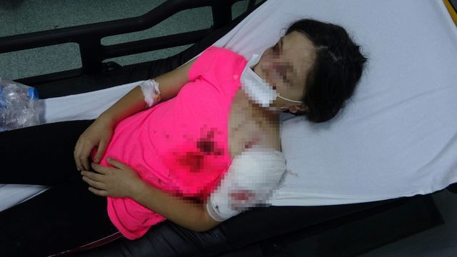 Samsun'da pitbull 11 yaşındaki çocuğu bu halde getirdi! Kanlar içinde kaldı - Resim: 2