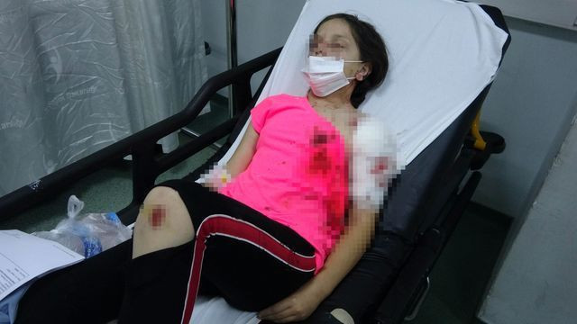 Samsun'da pitbull 11 yaşındaki çocuğu bu halde getirdi! Kanlar içinde kaldı - Resim: 3