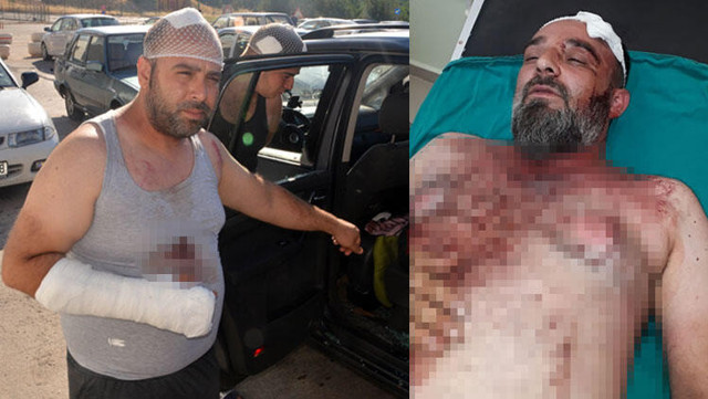 Kahramanmaraş'ta gurbetçi aileye dinlenme tesisinde saldırı - Resim: 0