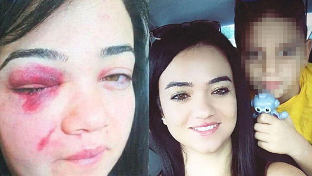 Eski eşi afla çıkan Zeliha Erdemir : Adam öldüreceğim diyor - Resim: 0