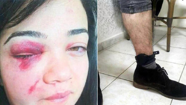 Eski eşi afla çıkan Zeliha Erdemir : Adam öldüreceğim diyor - Resim: 1