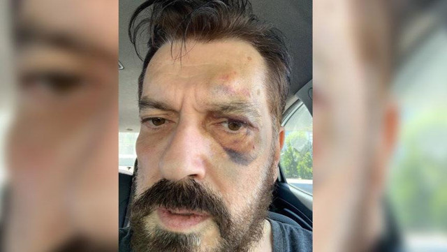 Ünlü anketçi Hakan Bayrakçı uğradığı saldırıyı anlattı: Yiyorsa tek gel dedim, 5 kişi geldiler - Resim: 0