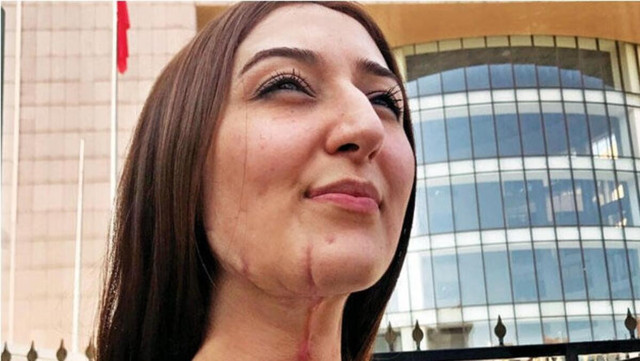 Avcılar'daki falçatalı dehşet! Emre Çiçek'e 53 yıla kadar hapis cezası istendi - Resim: 1