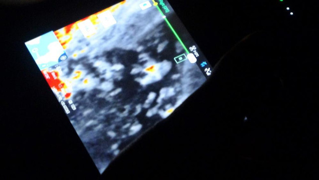 Antalya'da 11 yaşında dağa çıkan çocuk kayalık alanda ölü bulundu - Resim: 0