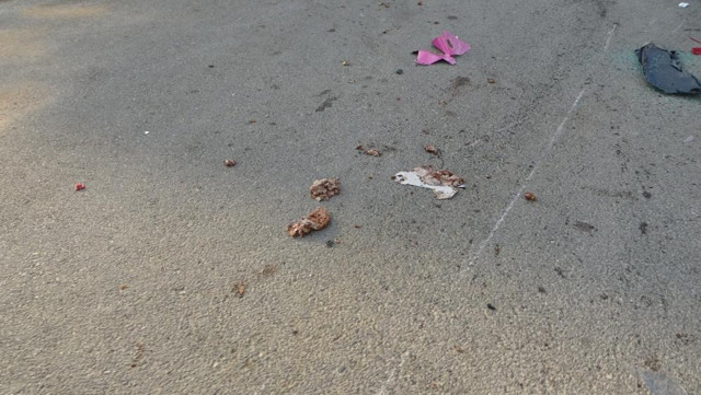 Antalya'da eşine doğum günü sürprizi yapacaktı ölüm fırsat vermedi - Resim: 1