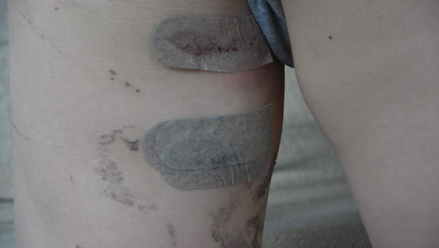 Denizli'de ölü taklidi yapan 9 yaşındaki çocuk parçalanmaktan kurtuldu - Resim: 0