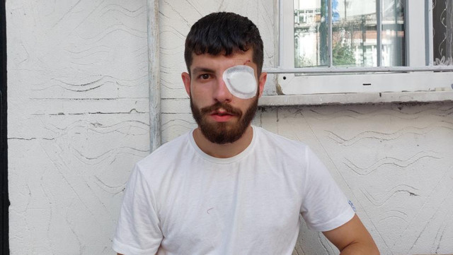 Sigortasız çalıştırılan işçi, sigorta isteyince olanlar oldu! Cam bardak fırlattıp, bu hale getirdiler... - Resim: 0