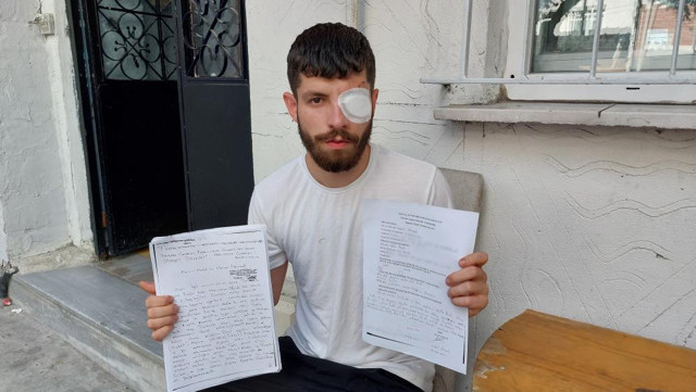 Sigortasız çalıştırılan işçi, sigorta isteyince olanlar oldu! Cam bardak fırlattıp, bu hale getirdiler... - Resim: 1