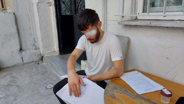 Sigortasız çalıştırılan işçi, sigorta isteyince olanlar oldu! Cam bardak fırlattıp, bu hale getirdiler... - Resim: 2