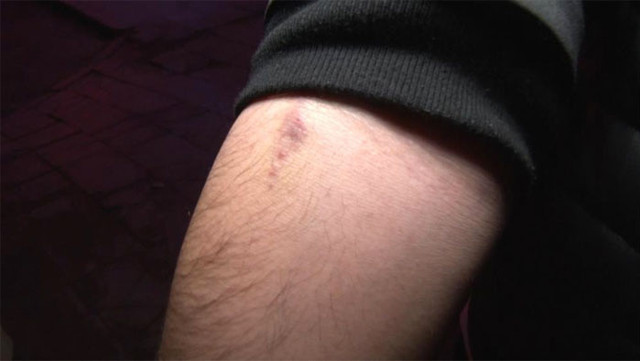 Skandal iddia! Doktor hastasını morfin bağımlısı haline getirip 700 bin TL'sini aldı - Resim: 0