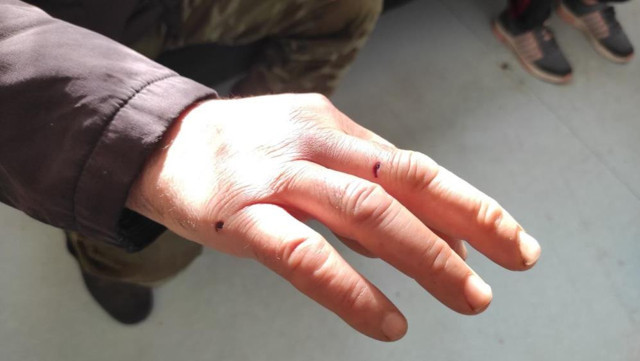 Eşinin evini tüfekle bastı, dehşet saçtı! Cani kocanın yaptıkları kan dondurdu: "Ayağına poşet eriterek..." - Resim: 4