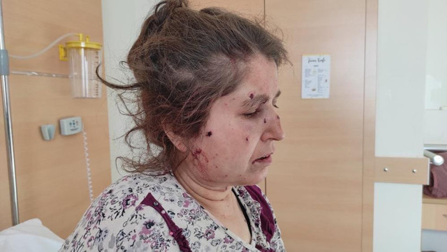 Eşinin evini tüfekle bastı, dehşet saçtı! Cani kocanın yaptıkları kan dondurdu: "Ayağına poşet eriterek..." - Resim: 3