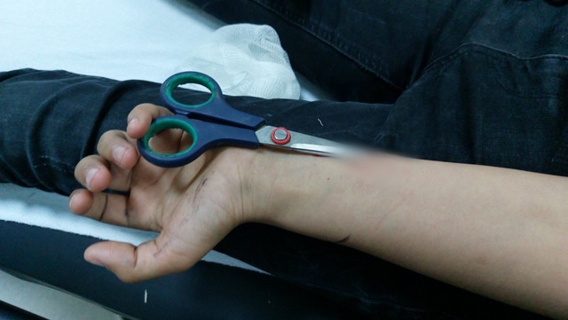 Cüzdanını almak isterken bileğine saplanan makasla hastaneye kaldırıldı - Resim: 0