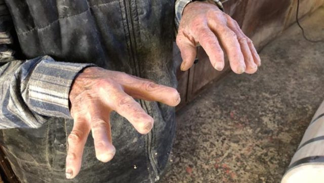 72 yıldır ürettiği fıçılar yüzünden elleri bu hale geldi! - Resim: 3