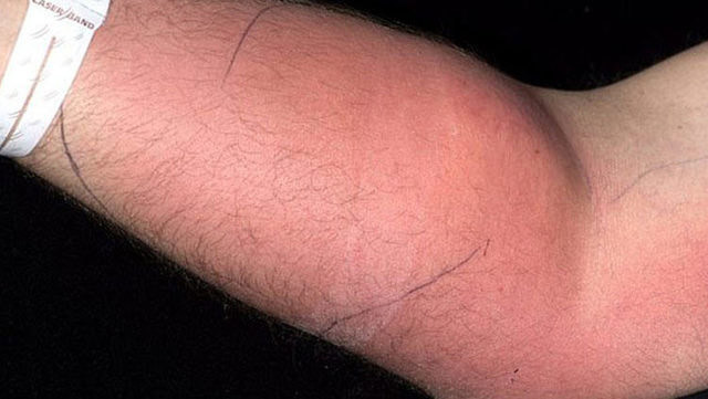 18 ay boyunca koluna sperm enjekte etti! Bakın sonrasında ne oldu - Resim: 3