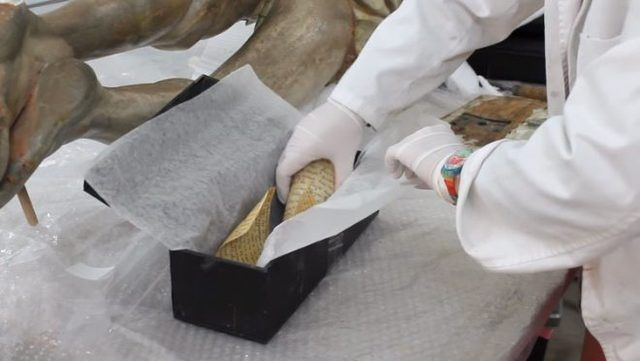 Kalçasından çıkana uzmanlar bile şaşırdı! - Resim: 2