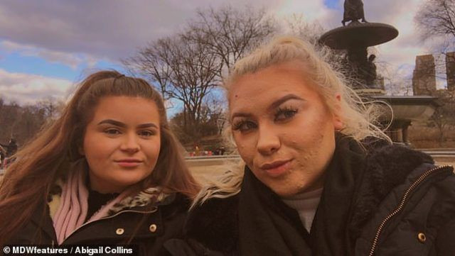 Genç kızın acı dramı günde 2 saatini makyaja harcıyor! İşte sebebi - Resim: 3