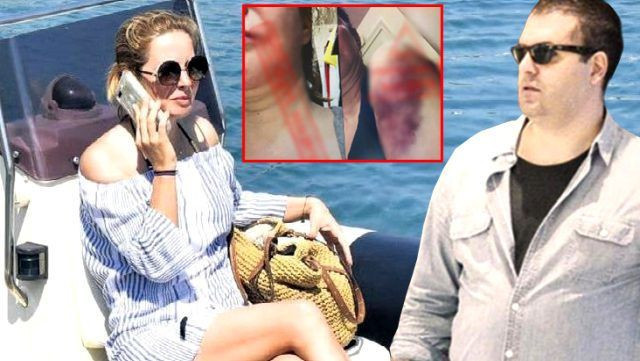 Tansu Çiller'in oğlu Mert Çiller eşinin kafasını duvardan duvara vurdu fuhuş detayı bomba - Resim: 2