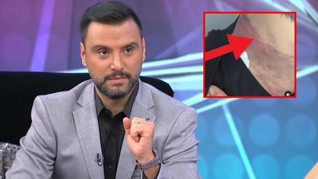 Alişan estetik yaptırırken ölümden nasıl döndüğünü itiraf etti başına gelenler şoke etti - Resim: 2