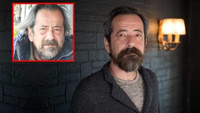 Feridun Düzağaç operasyon geçirdi göz altı morlukları için 'dayak yedim' dedi - Resim: 2