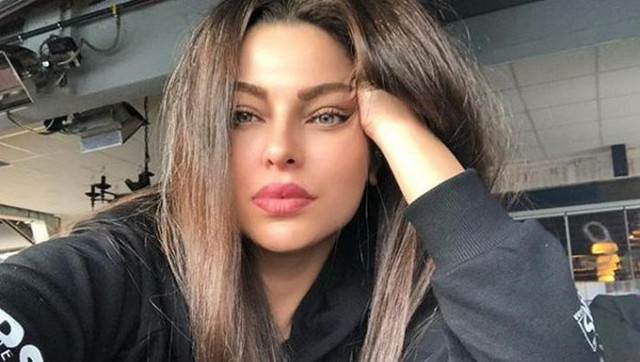 Sinem Umaş kaç yaşında kimdir Sinem Umaş kolunu yaktı son durumu - Resim: 2