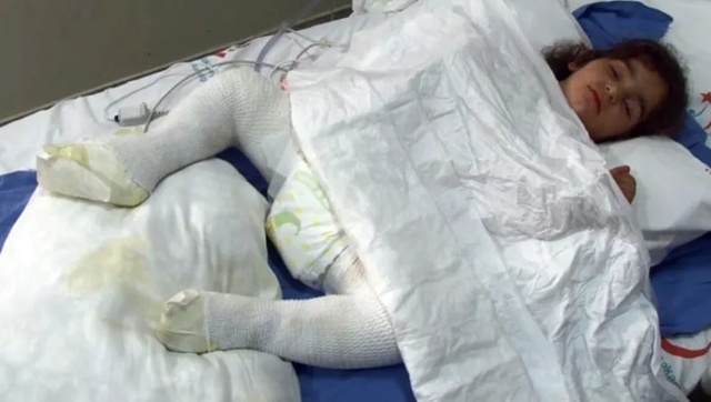 Iğdır'da akılalmaz olay! Oyun oynarken tandıra düşen çocuk yandı - Resim: 0