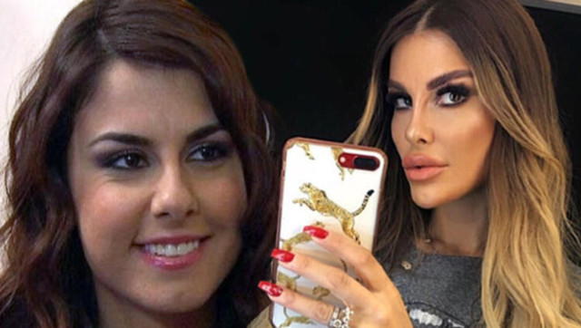 Tuğçe Özbudak eski hali nasıldı estetiksiz hali bambaşkaymış! - Resim: 0