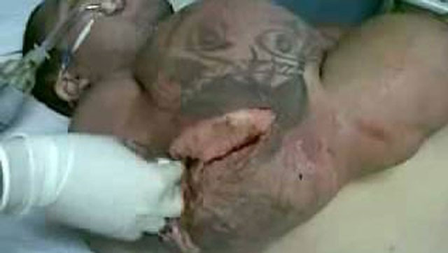 Steroidlerin kötüye kullanımı bakın insana neler yapıyor - Resim: 3