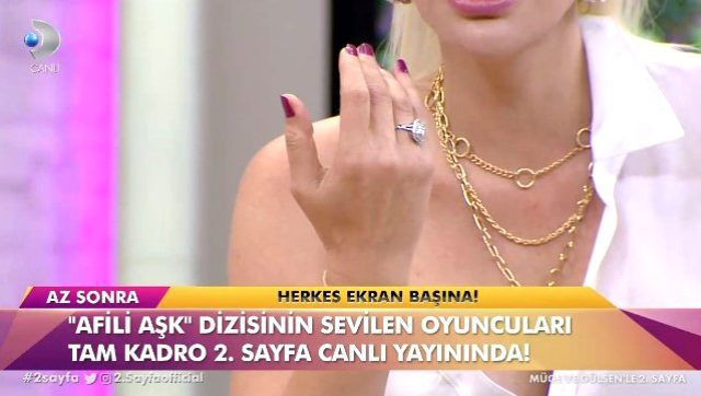 Aylin Coşkun'un düğün itirafı! Eşiyle ona takılan altınlardan kolları kanamış - Resim: 2