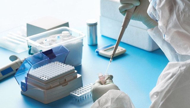 Kovid-19'u 4 gün içinde vücuttan atan antikor geliştirildi ABD'de umutlandıran keşif! - Resim: 0