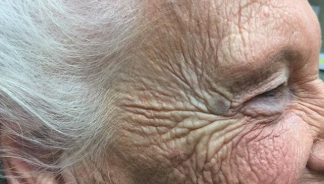 Siyah nokta sanıyordu bakın ne çıktı! - Resim: 3