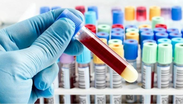 Covid-19 PCR testlerinde varyant endişesi! Bilim Kurulu Üyesi Kayıpmaz açıklık getirdi - Resim: 0
