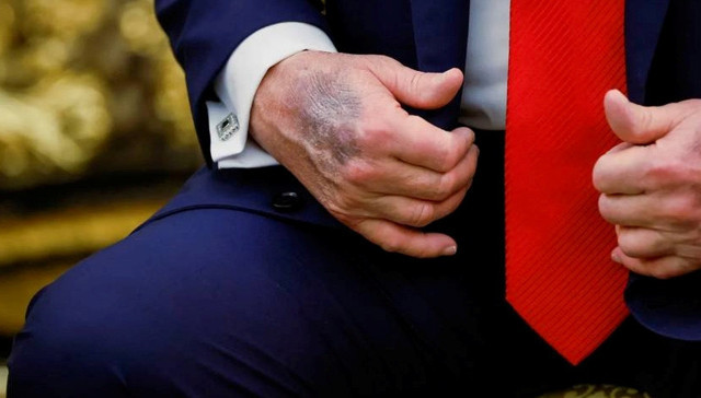 Trump elindeki morlukların nedenini anlattı - Resim: 0