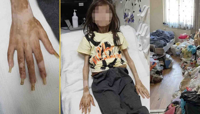 Türkiye çöp evde bulunan çocuğu konuşmuştu! Teyze ve kuzenin cezası belli oldu - Resim: 0