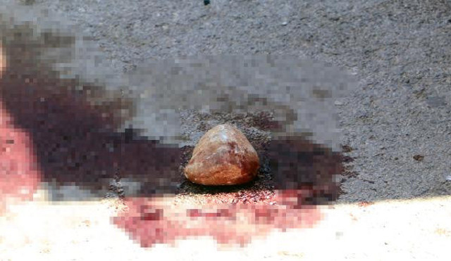 Evi terk eden eşini, başına mermer ve taşla vurarak ağır yaraladı - Resim: 0