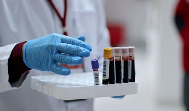 İmmün plazma tedavisi! Kızılay Başkanı'ndan önemli açıklamalar - Resim: 1