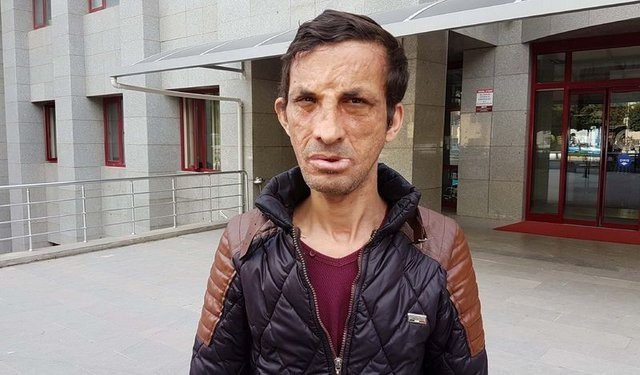 Yüzleri de hayatları da değişti - Resim: 2