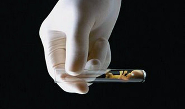 Tüp bebekte sperm az veya yoksa ne yapılır? Cinsel ilişki sakancalı mı? - Resim: 0