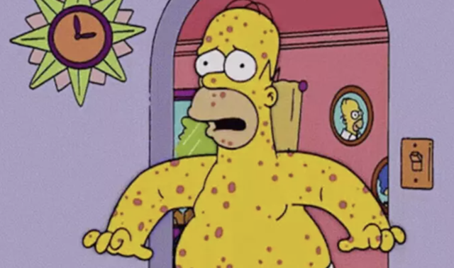Maymun Çiçeği virüsünde Simpsonlar detayı! Yine bildler - Resim: 2