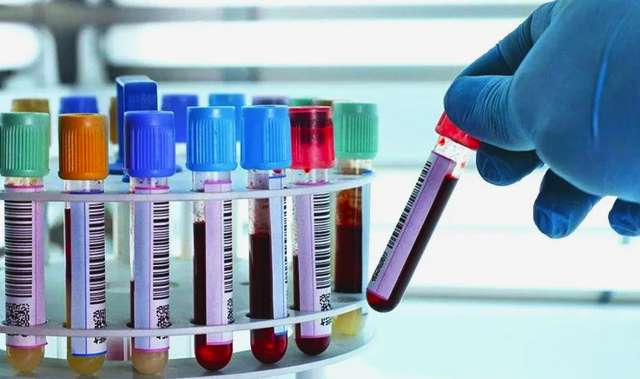 A Rh+ kan gurubuna sahip olanlar dikkat! Yorgunluğun çaresi belli oldu - Resim: 0