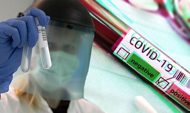 Oxford'un geliştirdiği aşı testlerinde olumlu sonuç! 28 günde tamamen iyileştirdi - Resim: 0