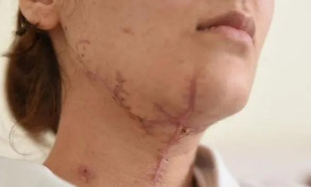 Avcılar'daki falçatalı dehşet! Emre Çiçek'e 53 yıla kadar hapis cezası istendi - Resim: 0